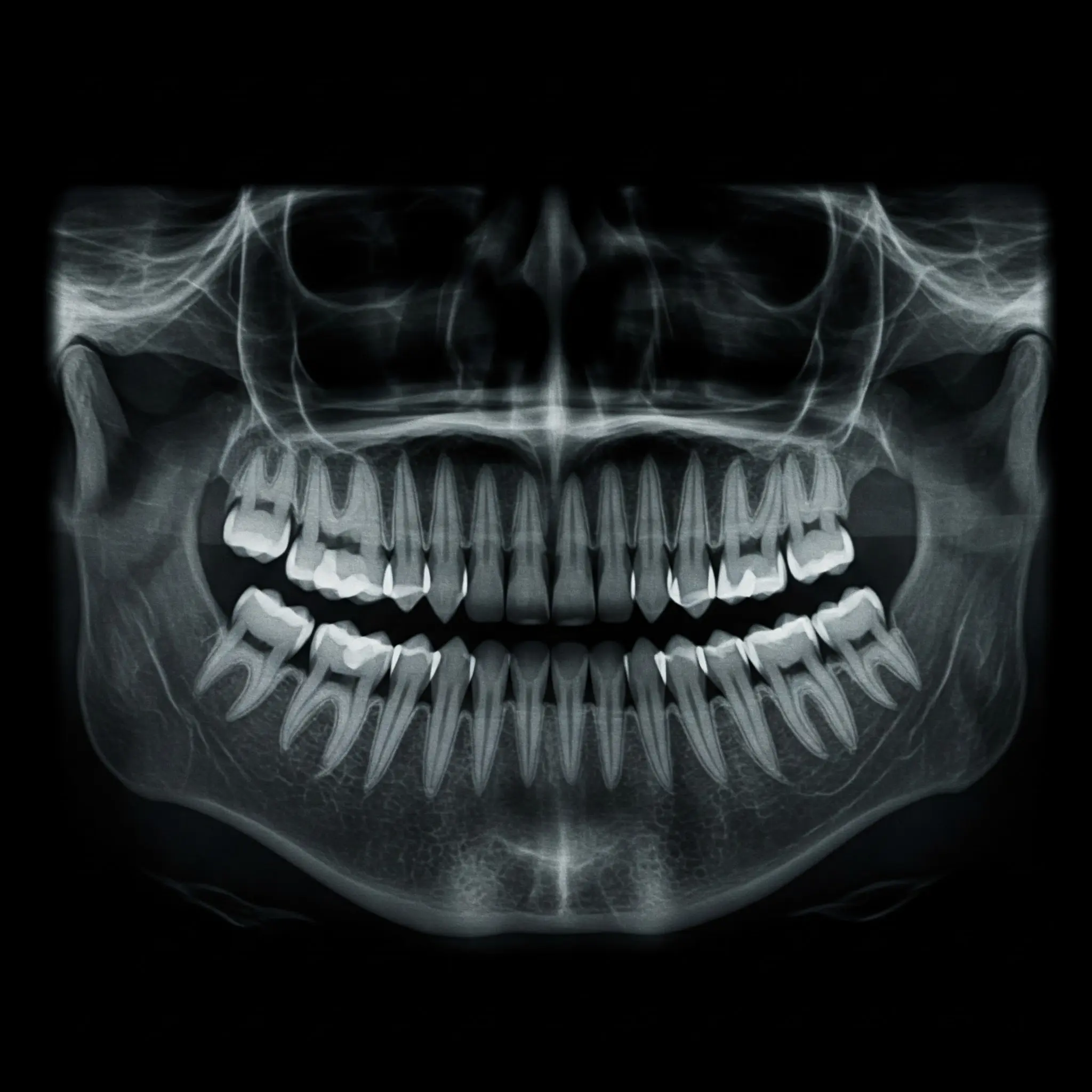 Panoramic X-ray